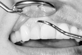 Parodontitis Therapie in der Praxis für Mund-, Kiefer- und Gesichtschirurgie