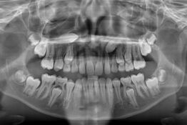 Die Praxis für Mund-, Kiefer- und Gesichtschirurgie behandelt Zahn-, Mund- und Kiefererkrankungen