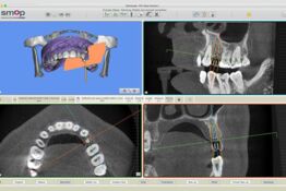 Praxis für Mund-, Kiefer- und Gesichtschirurgie mit 3D- Planungssoftware